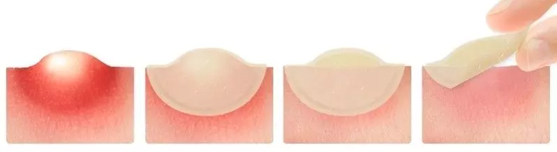 Elizavecca Witch Piggy Hell-Pore Blemish Spot Patch.jpg