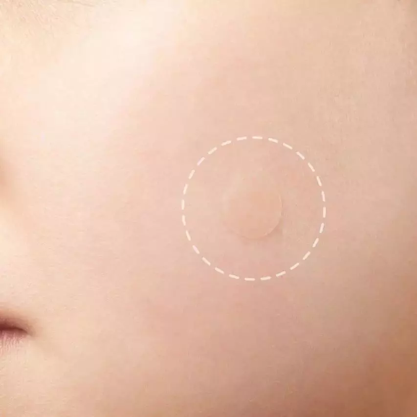 Антибактериальные наклейки против прыщей Some By Mi 30 Days Miracle Clear Spot Patch_KIMMI.jpg